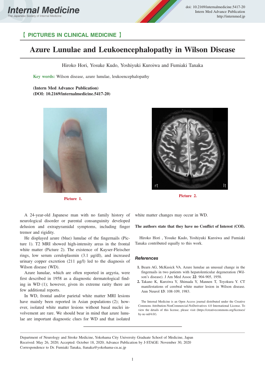 JCM | Free Full-Text | Clinical and Forensic Signs Resulting from Exposure  to Heavy Metals and Other Chemical Elements of the Periodic Table