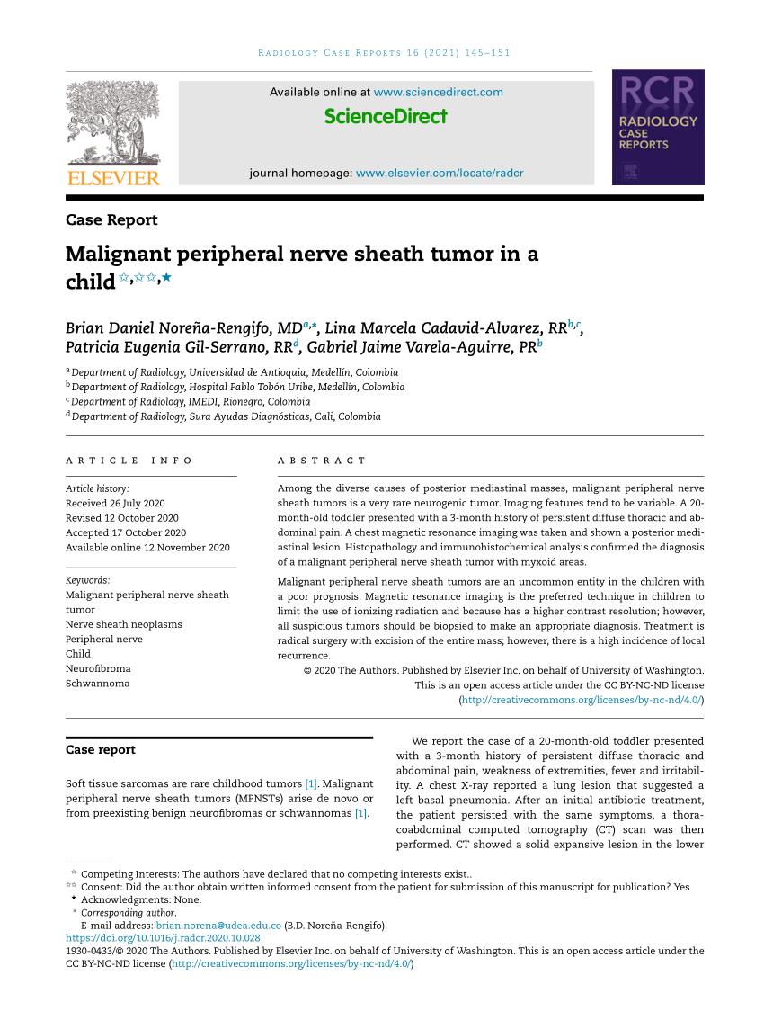 Anterior mediastinal masses in children - ScienceDirect