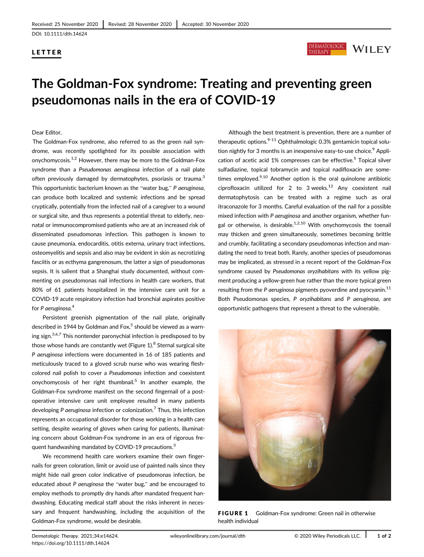 Going green: The complexities of the green nail syndrome