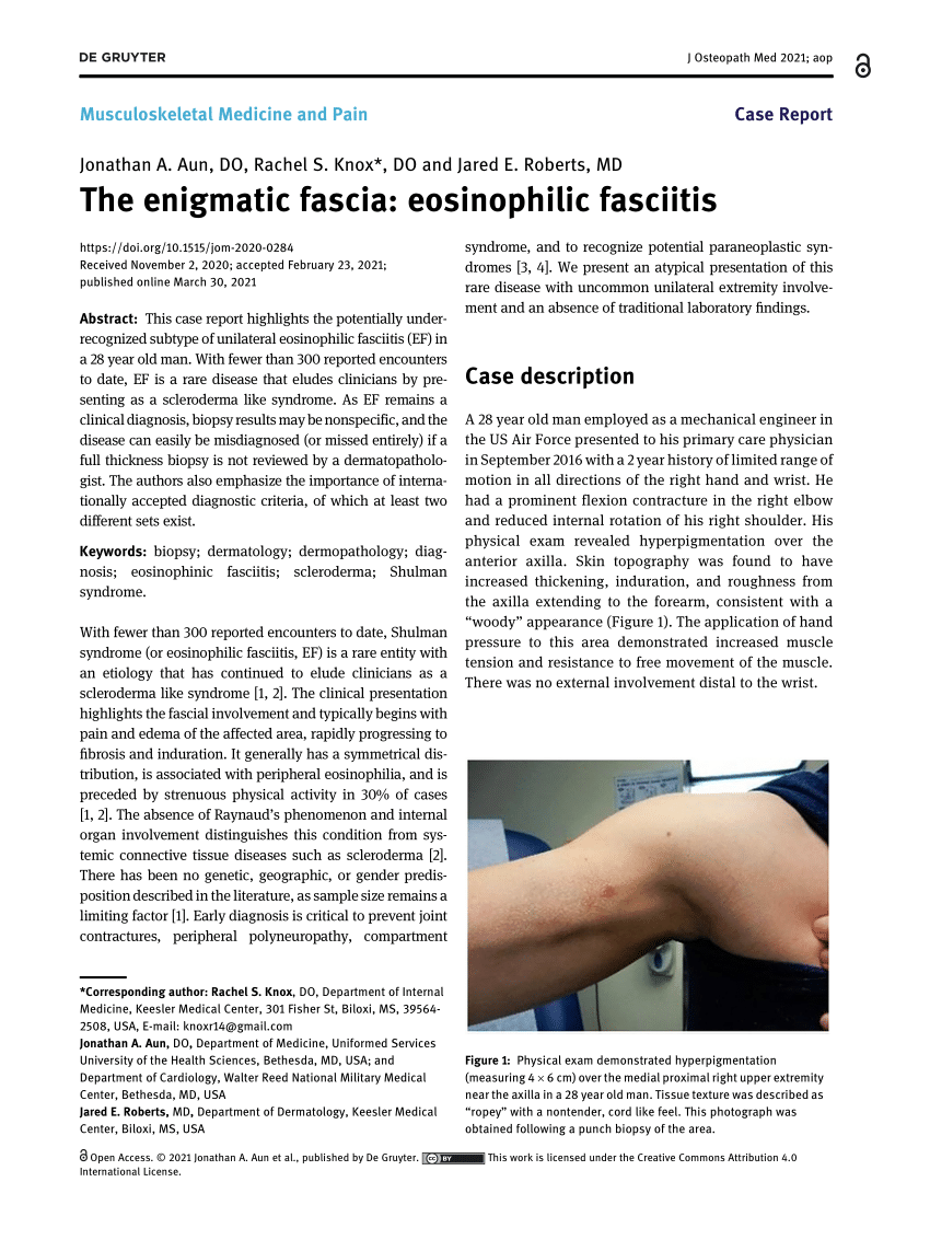 Pdf The Enigmatic Fascia Eosinophilic Fasciitis