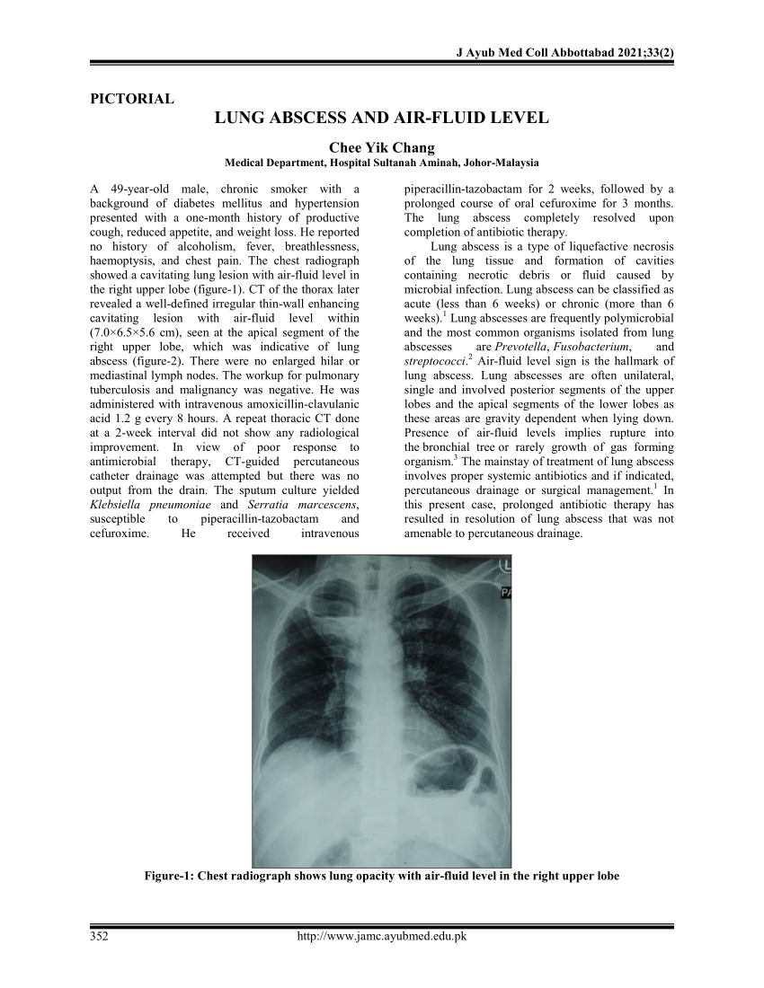 pdf-lung-abscess-and-air-fluid-level