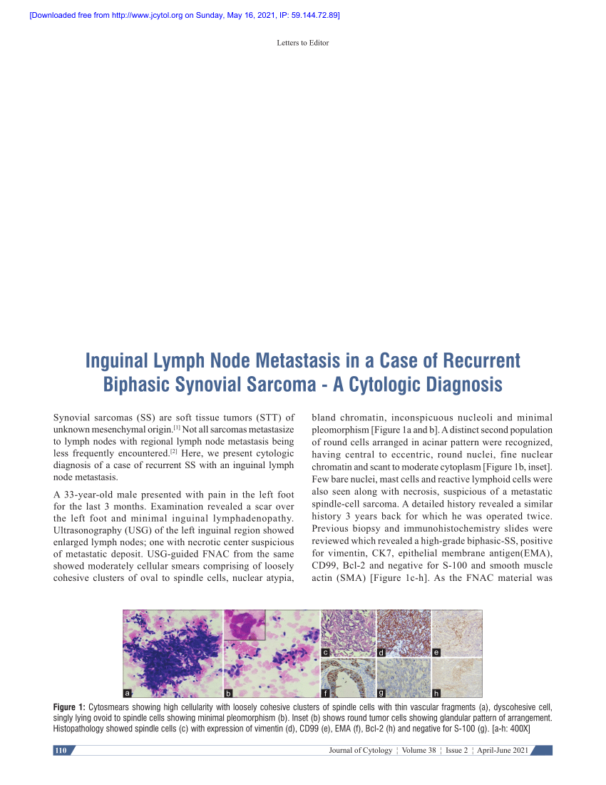 Pdf Inguinal Lymph Node Metastasis In A Case Of Recurrent Biphasic Synovial Sarcoma A 