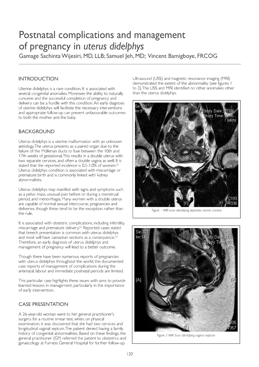 pdf-postnatal-complications-and-management-of-pregnancy-in-uterus