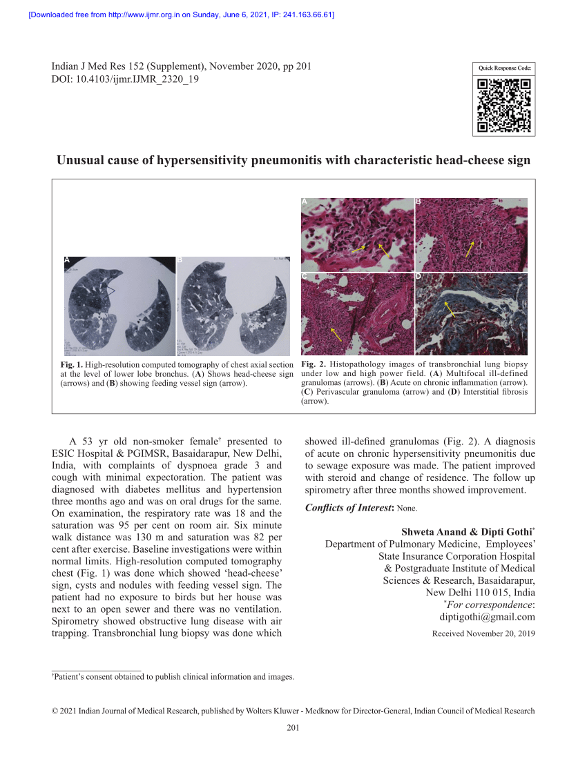 (PDF) Unusual cause of hypersensitivity pneumonitis with characteristic