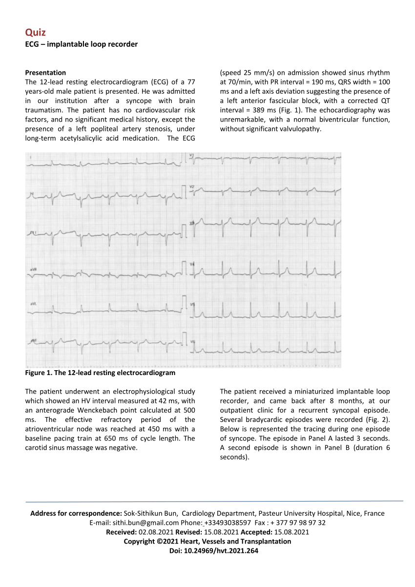 (PDF) ECG – implantable loop recorder