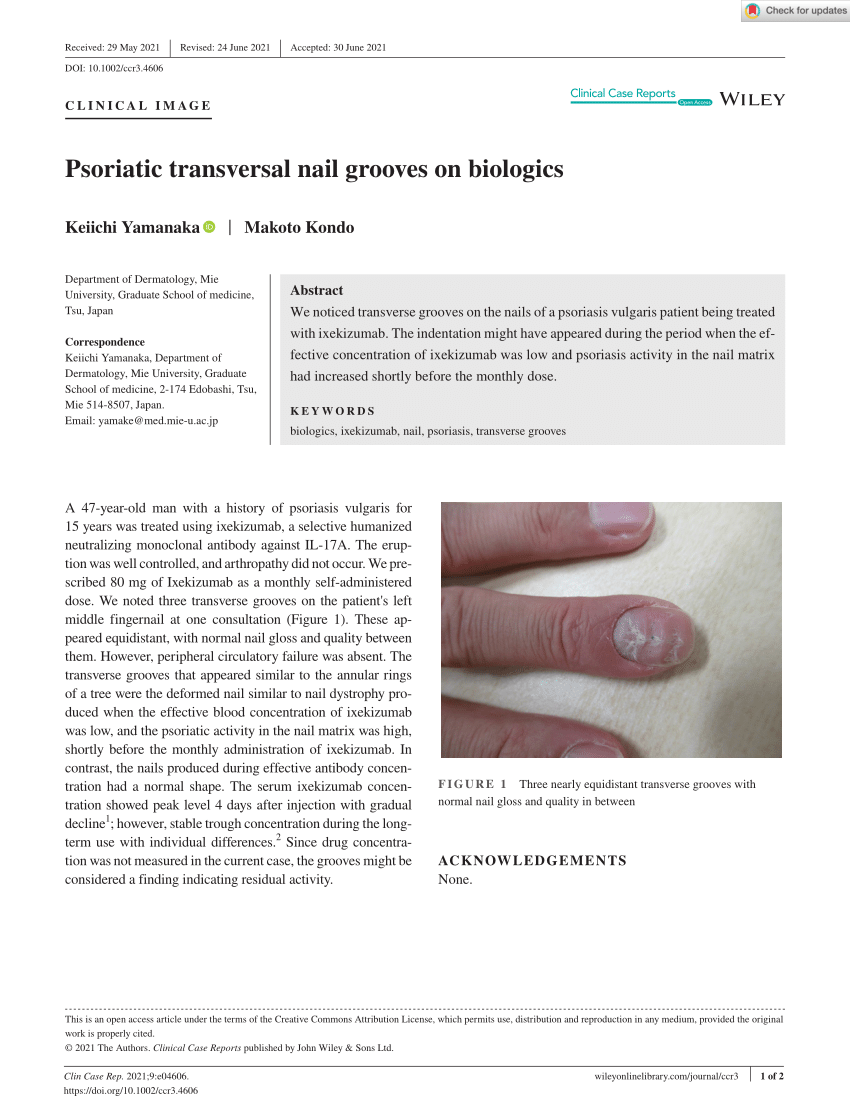 Vertical Ridges on Nails: Hi. Way before... - Thyroid UK