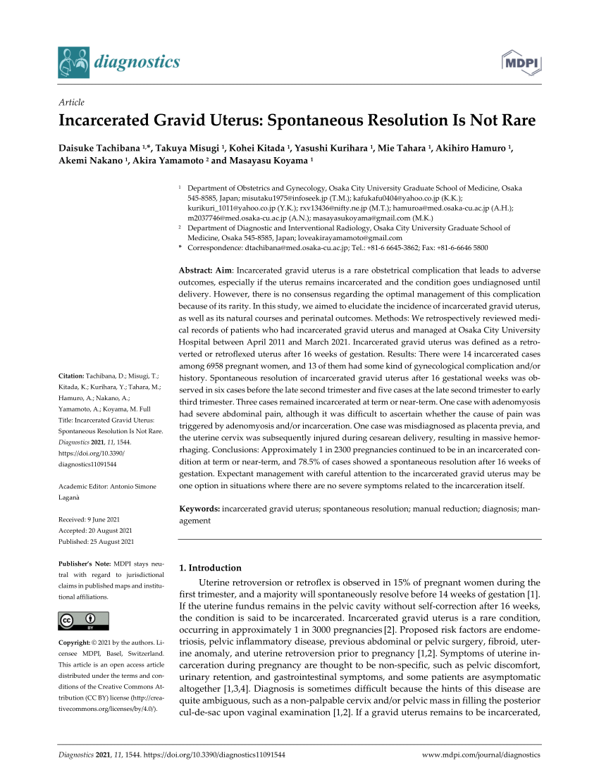 Acute Urinary Retention in Early Pregnancy: A Case Report