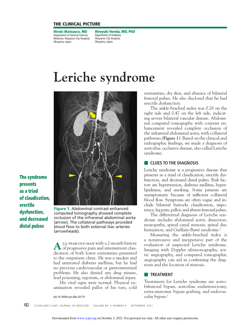 PDF Leriche syndrome