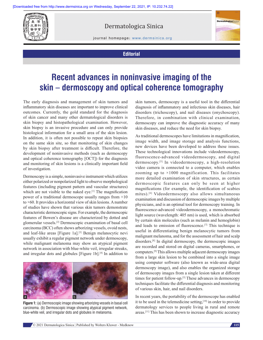 Pdf Recent Advances In Noninvasive Imaging Of The Skin Dermoscopy And Optical Coherence 3527