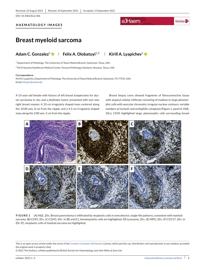 Pdf Breast Myeloid Sarcoma