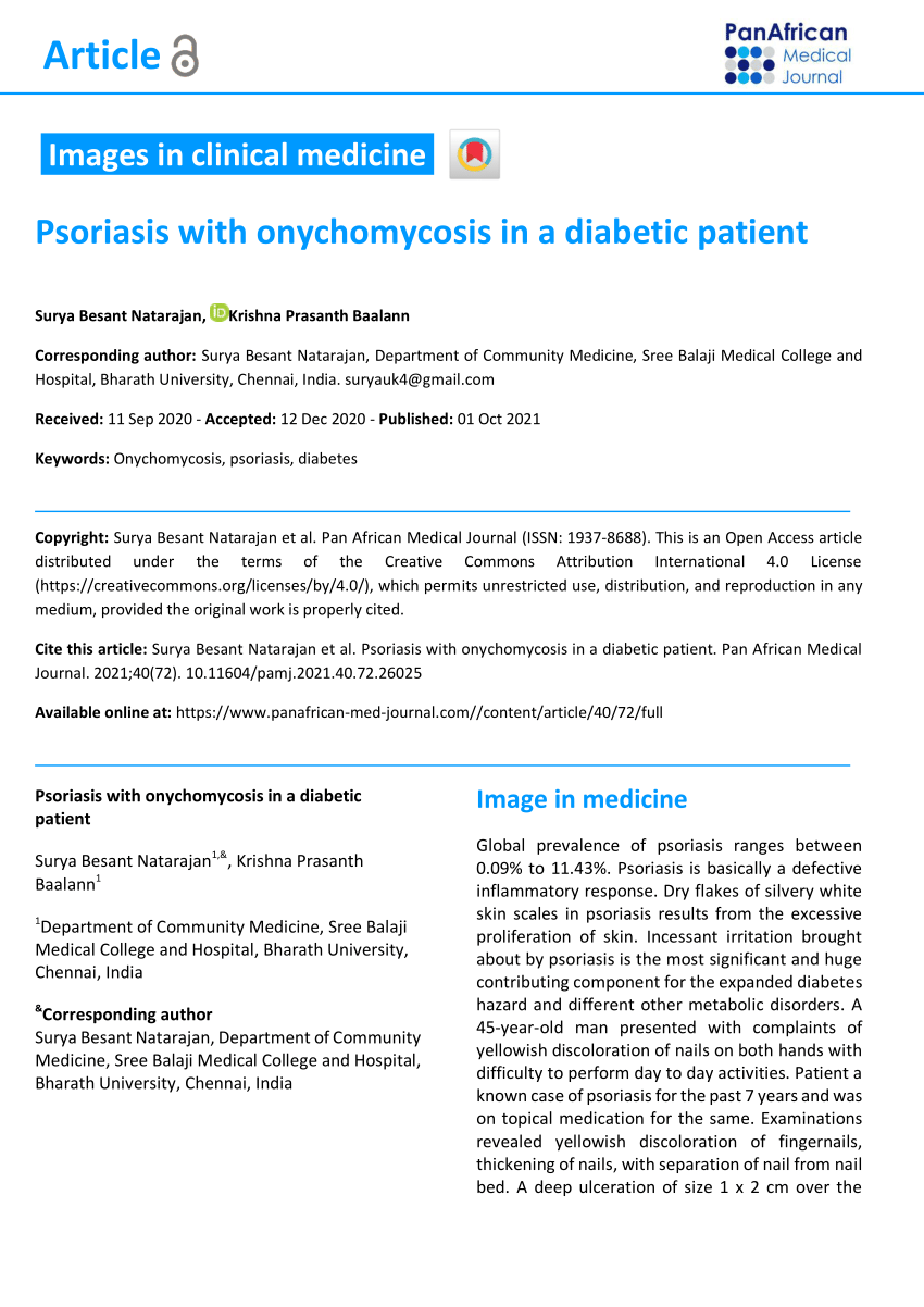 (PDF) Psoriasis with onychomycosis in a diabetic patient