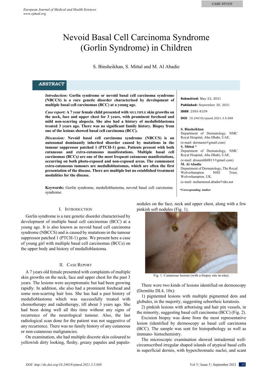 (PDF) Nevoid Basal Cell Carcinoma Syndrome (Gorlin Syndrome) in Children