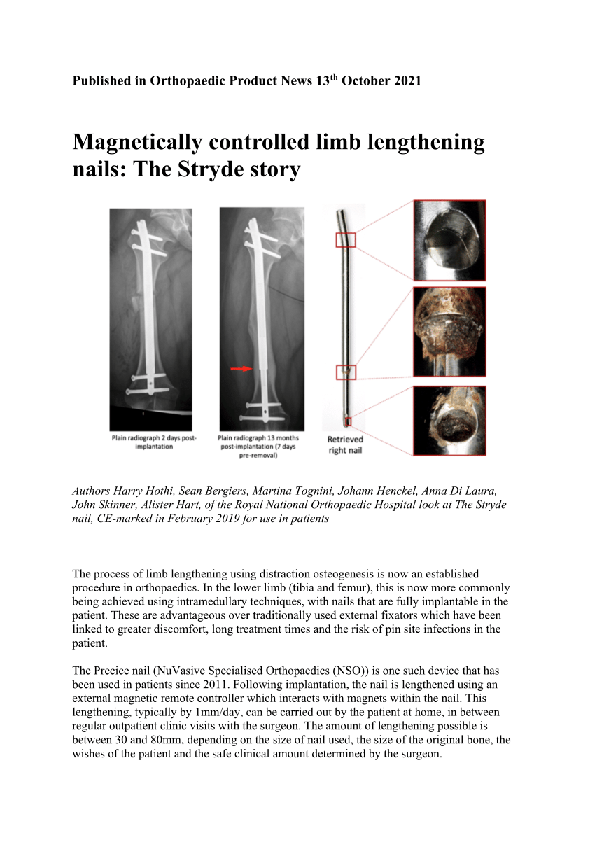 (PDF) controlled limb lengthening nails The Stryde story