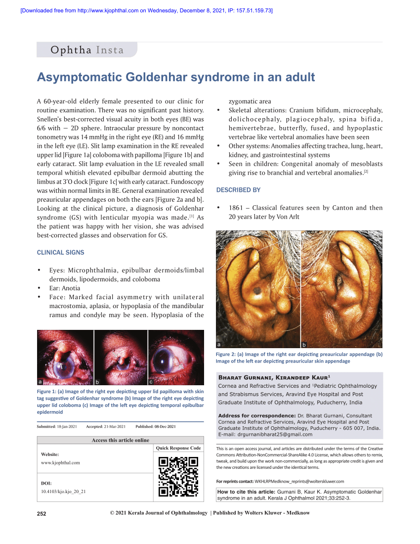 Pdf Asymptomatic Goldenhar Syndrome In An Adult