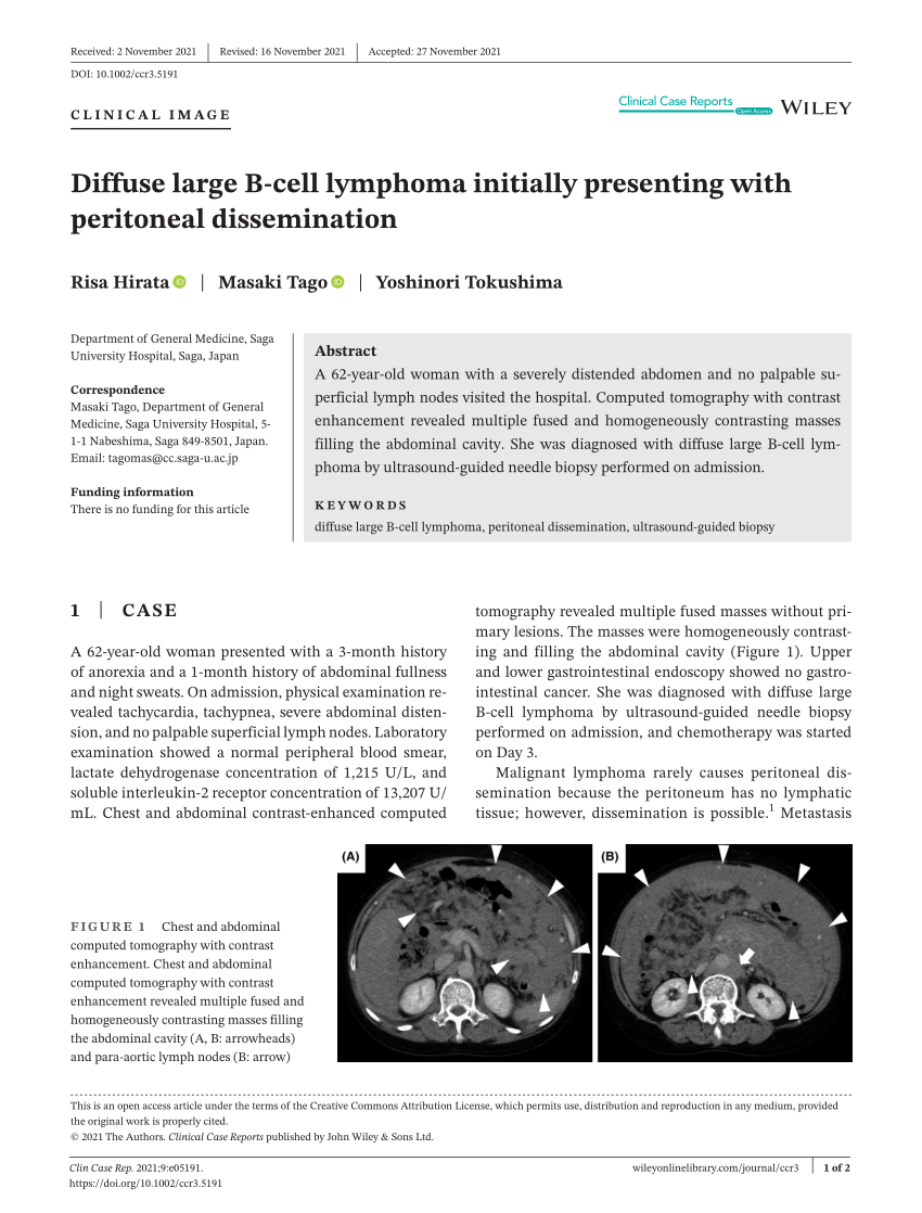 Pdf Diffuse Large B Cell Lymphoma Initially Presenting With Peritoneal Dissemination