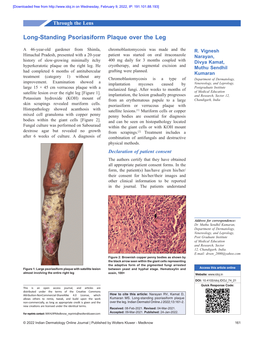 pdf-long-standing-psoriasiform-plaque-over-the-leg