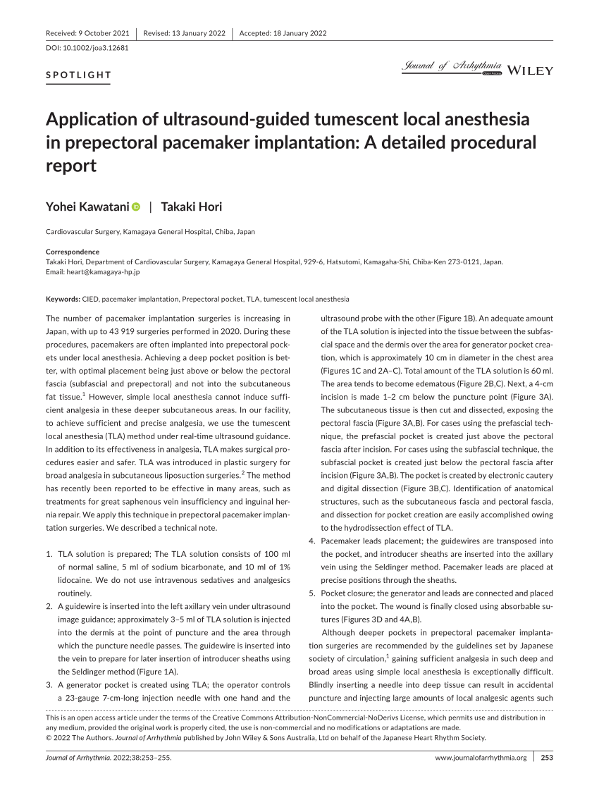 (PDF) Application of ultrasound‐guided tumescent local anesthesia in ...
