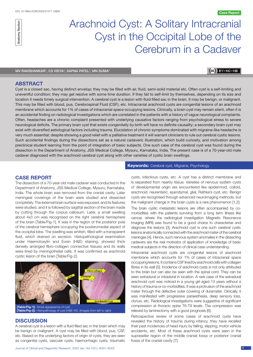 Pdf Arachnoid Cyst A Solitary Intracranial Cyst In The Occipital Lobe Of The Cerebrum In A 8816