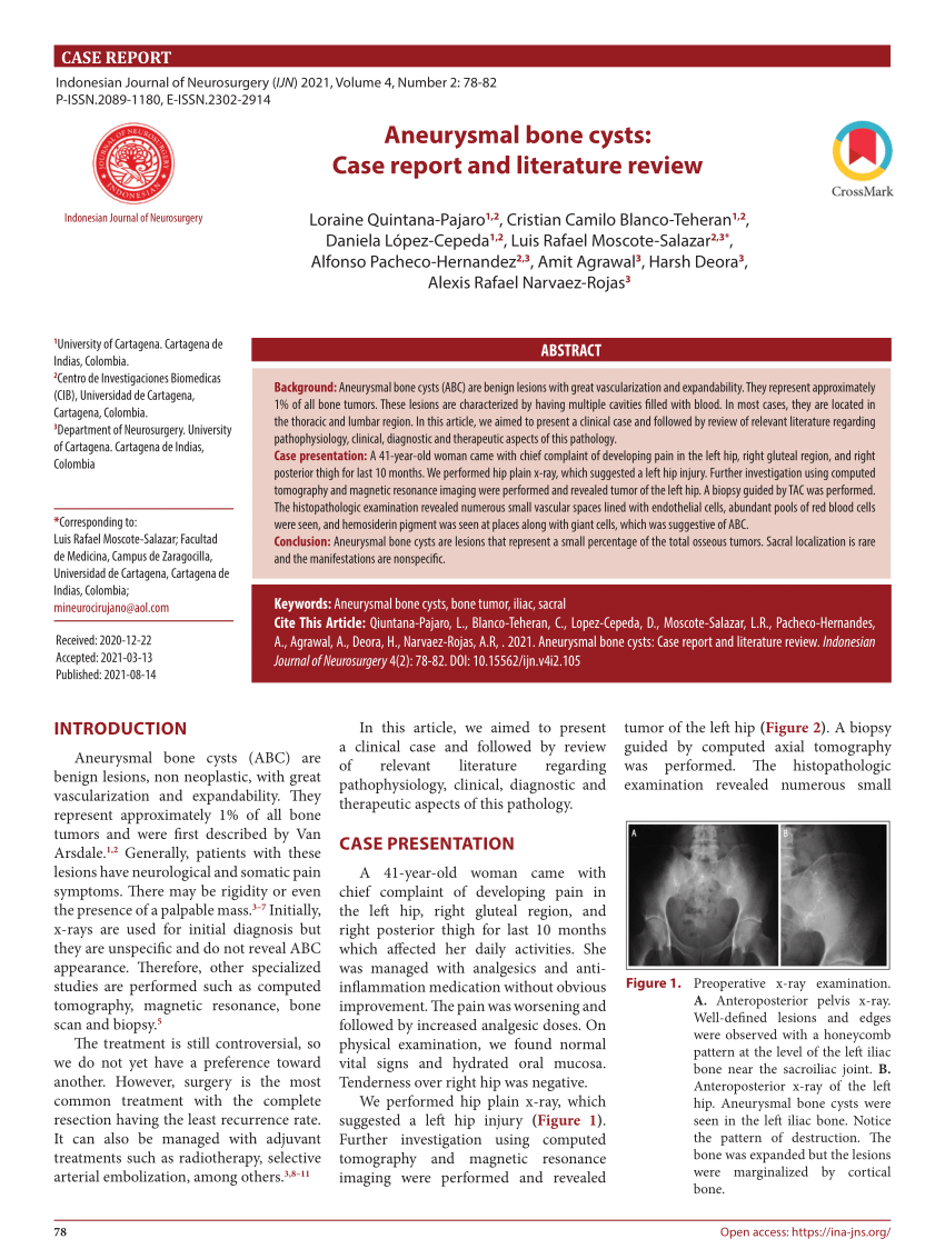 Pdf Aneurysmal Bone Cysts Case Report And Literature Review 7592