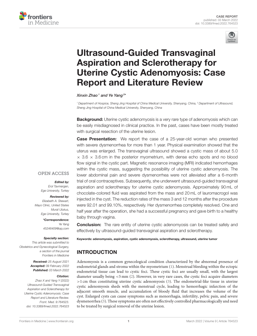 Pdf Ultrasound Guided Transvaginal Aspiration And Sclerotherapy For Uterine Cystic Adenomyosis