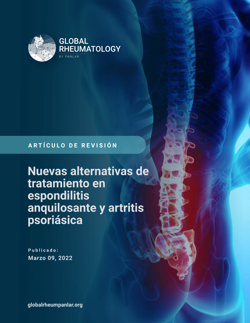 Espondilitis anquilosante: 11 signos de alerta por dolor en la espalda