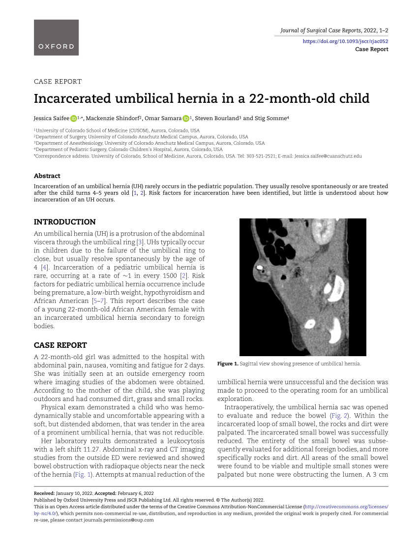 PDF] Spontaneous rupture of a congenital umbilical hernia in an infant: a  rare complication