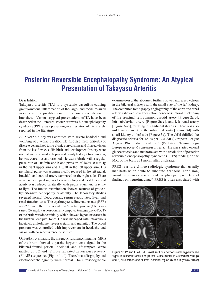 posterior reversible encephalopathy syndrome an atypical presentation of takayasu arteritis