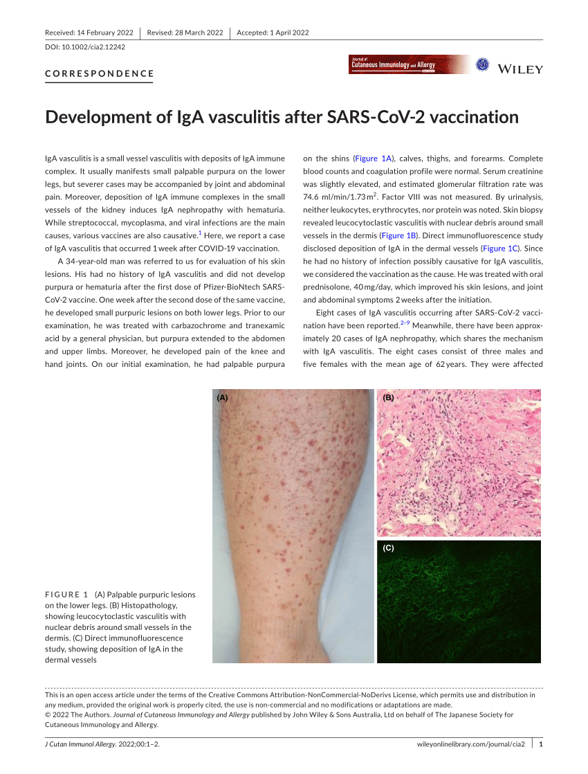 Pdf Development Of Iga Vasculitis After Sars‐cov‐2 Vaccination