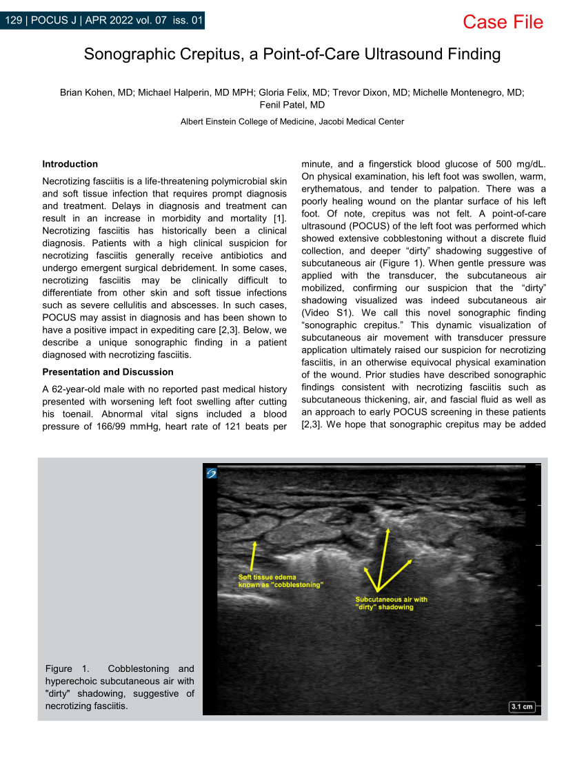 Pdf Sonographic Crepitus A Point Of Care Ultrasound Finding
