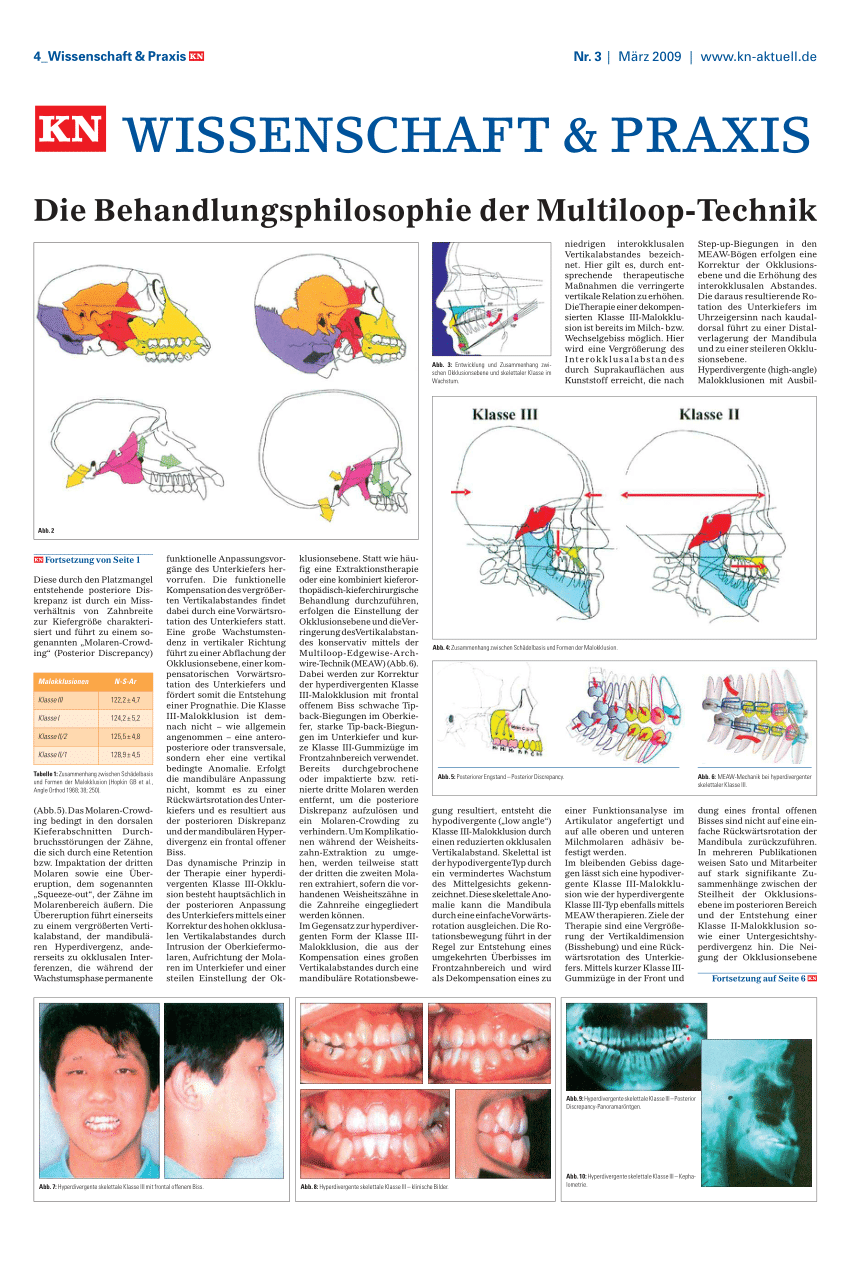 PDF) die-behandlungsphilosophie-der-multiloop-technik