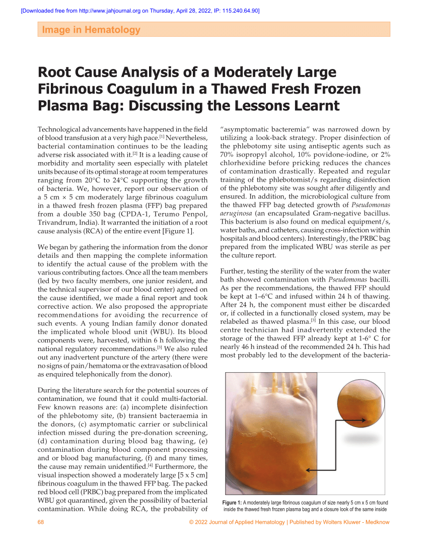 New Plasma Transfusion Guidelines from the British Society of Haematology -  Transfusion News