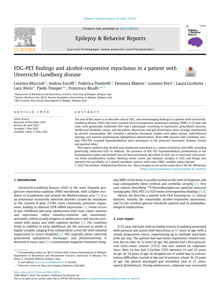 (PDF) FDG-PET findings and alcohol-responsive myoclonus in a patient