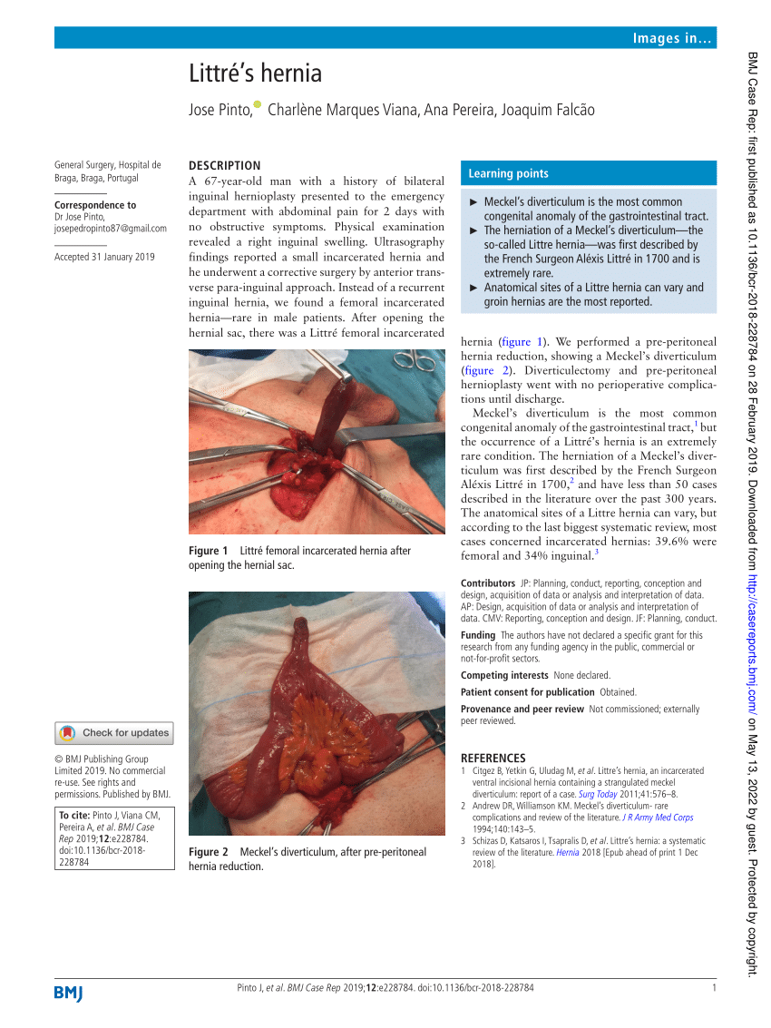 (PDF) Littré's hernia