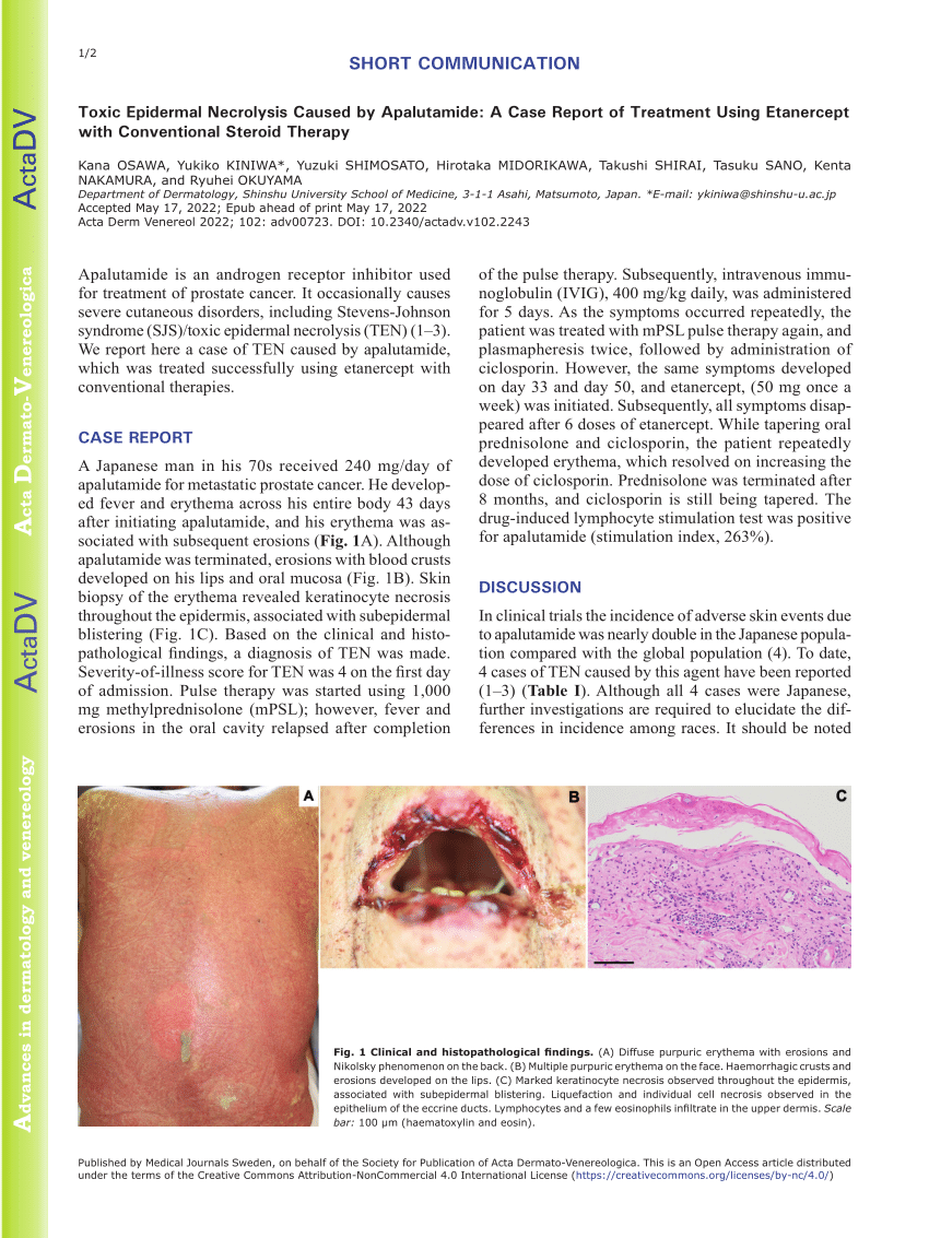 Pdf Toxic Epidermal Necrolysis Caused By Apalutamide A Case Report
