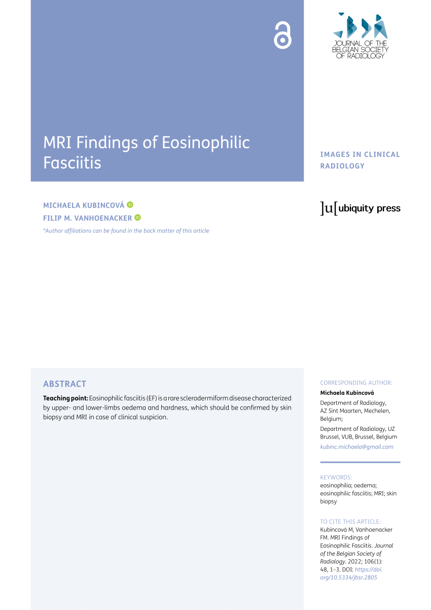 Pdf Mri Findings Of Eosinophilic Fasciitis