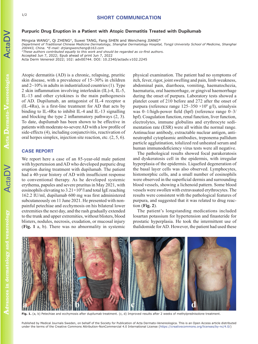 Pdf Purpuric Drug Eruption In A Patient With Atopic Dermatitis