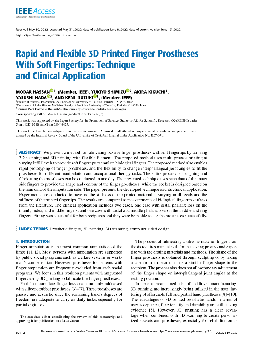 A movable finger Prosthesis  International Journal of Maxillofacial  Prosthetics