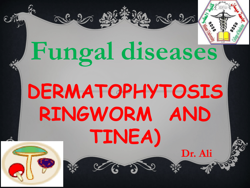 Pdf Fungal Diseases Dermatophytosis Ringworm And Tinea