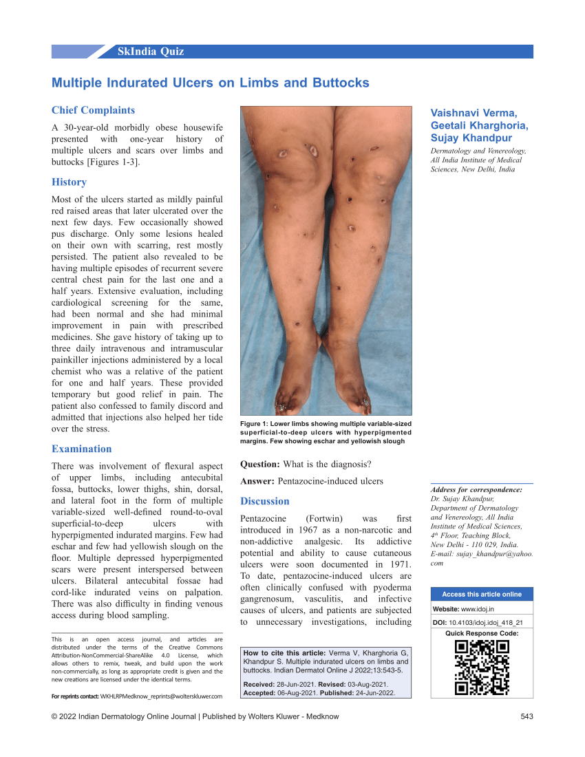 PDF) Multiple Indurated Ulcers on Limbs and Buttocks