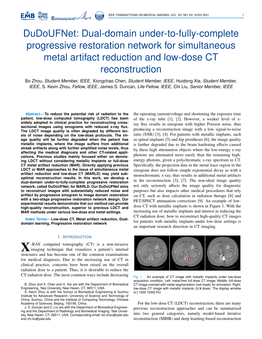 https://i1.rgstatic.net/publication/361928251_DuDoUFNet_Dual-domain_under-to-fully-complete_progressive_restoration_network_for_simultaneous_metal_artifact_reduction_and_low-dose_CT_reconstruction/links/62d6f289593dae2f6a28d6df/largepreview.png