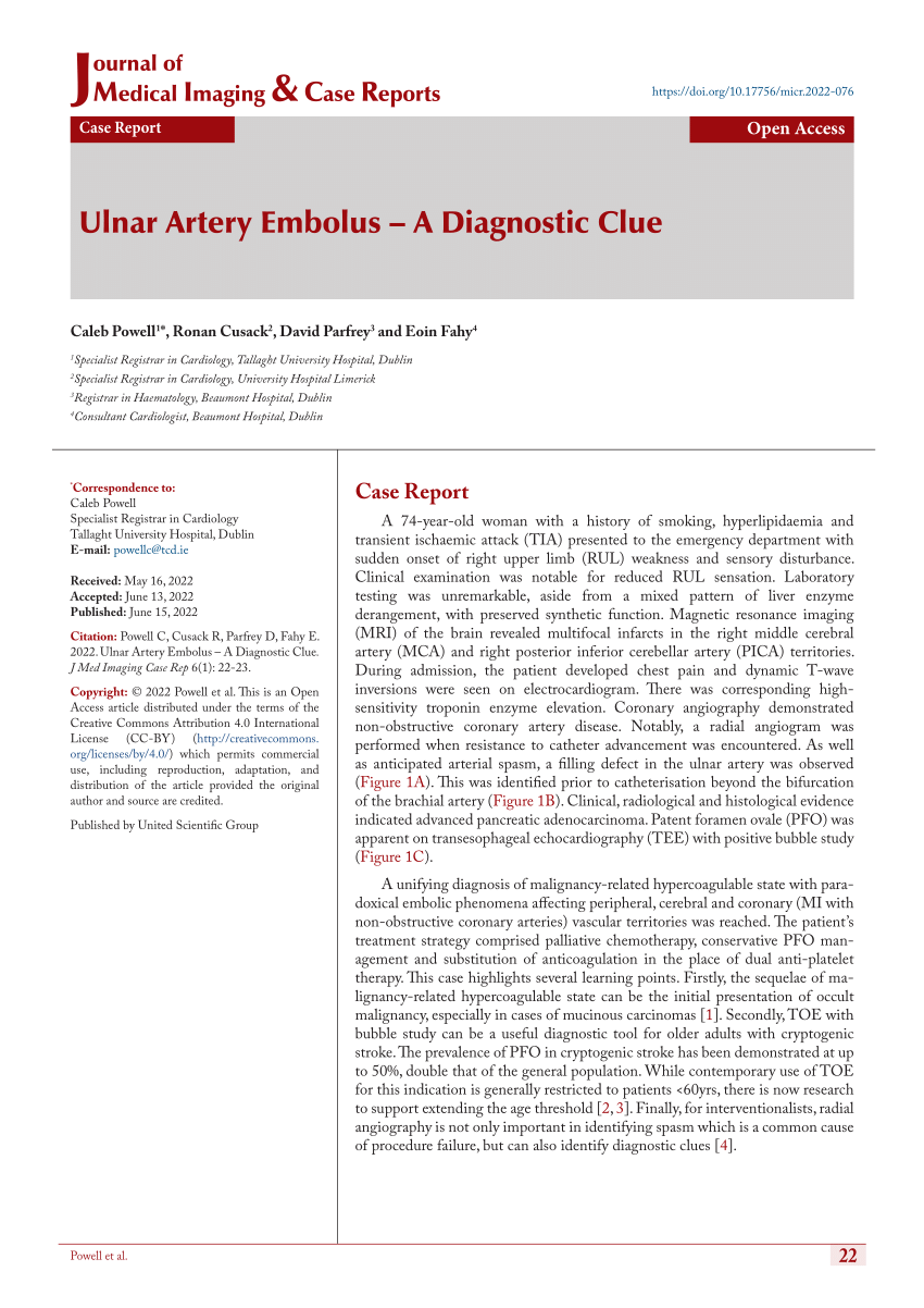 (PDF) Ulnar Artery Embolus A Diagnostic Clue