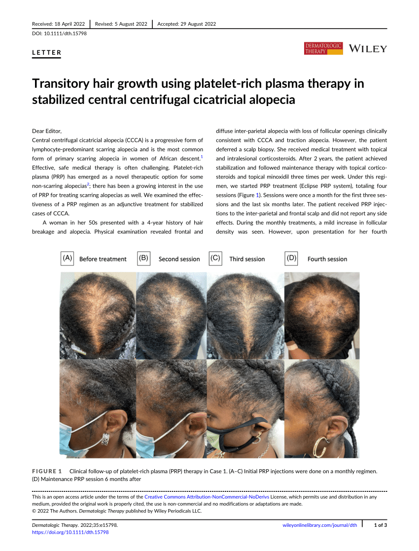 (PDF) Transitory Hair Growth using Platelet‐Rich Plasma Therapy in ...