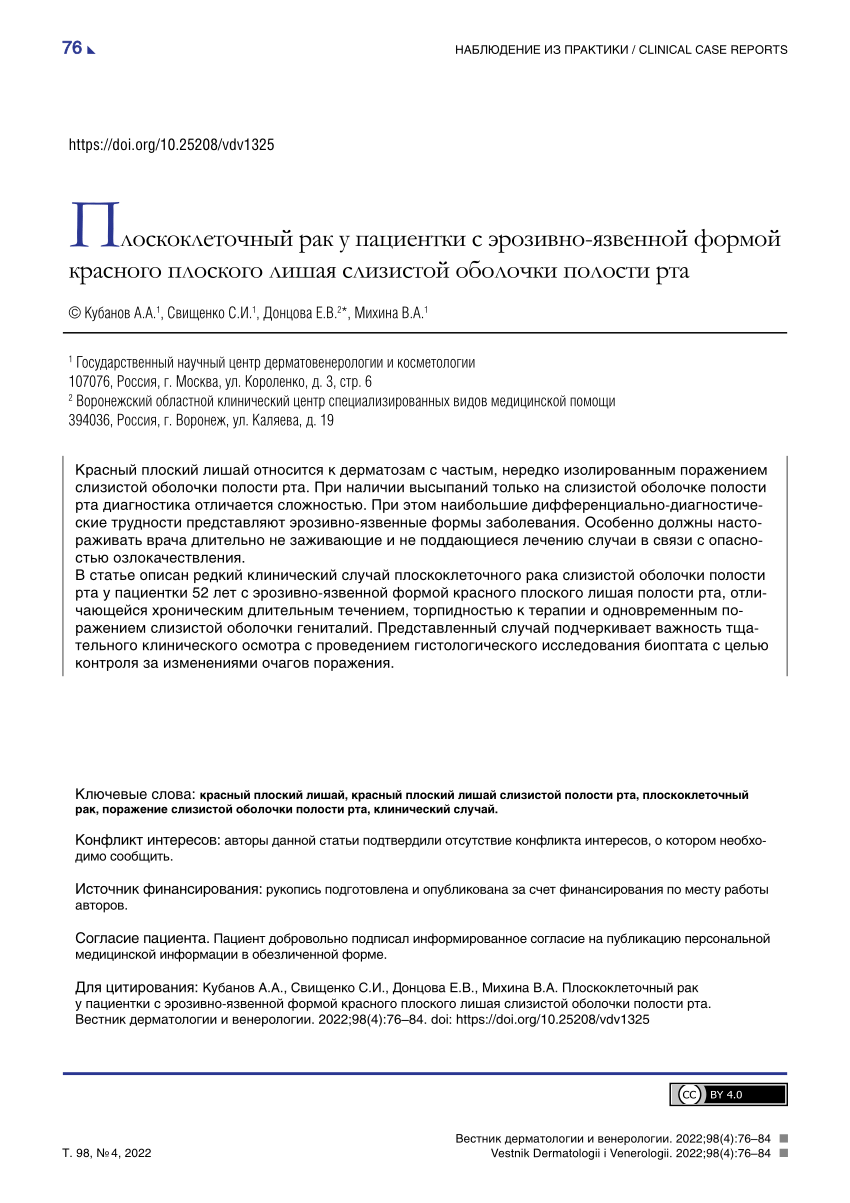 PDF) Squamous cell carcinoma in a patient with lichen planus of the oral  mucosa