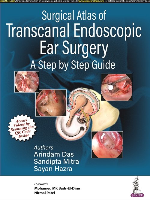 Pdf Surgical Atlas Of Transcanal Endoscopic Ear Surgery A Step By Step Guide