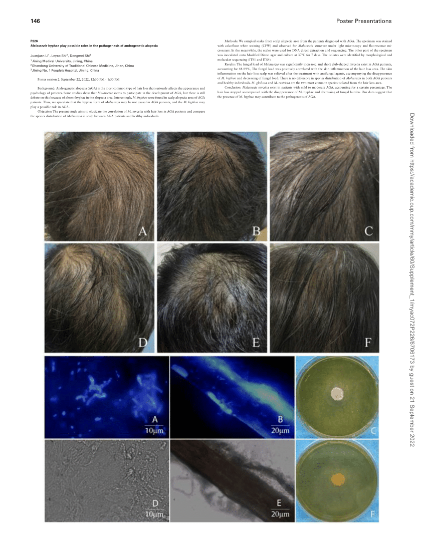 Pdf P Malassezia Hyphae Play Possible Roles In The Pathogenesis Of Androgenetic Alopecia