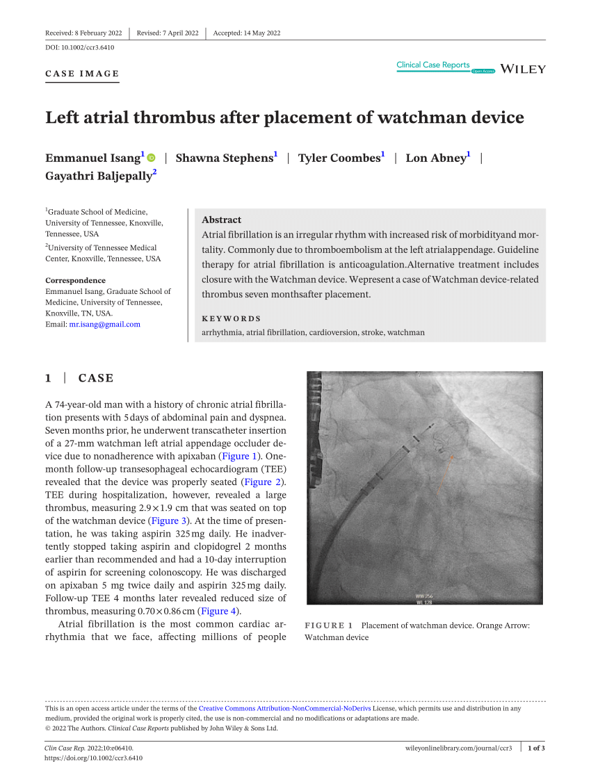 (PDF) Left atrial thrombus after placement of watchman device