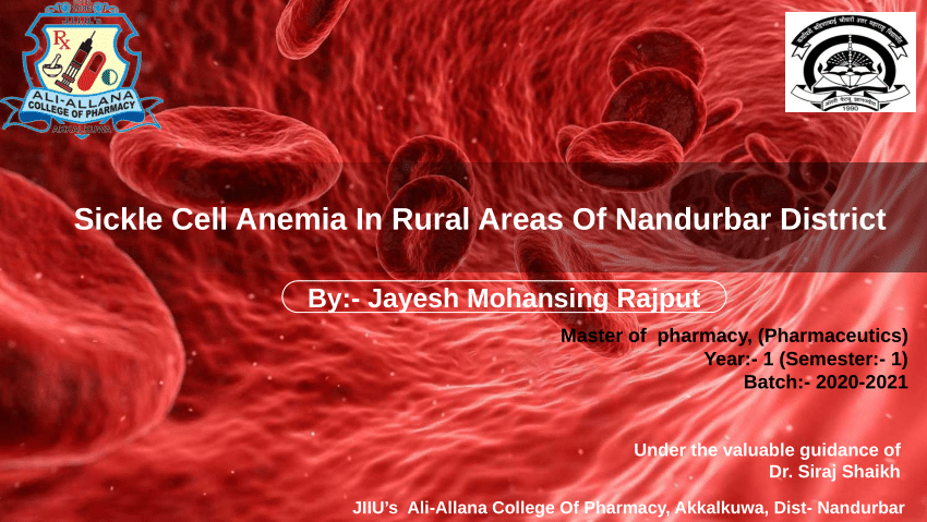 current research on sickle cell anemia 2022