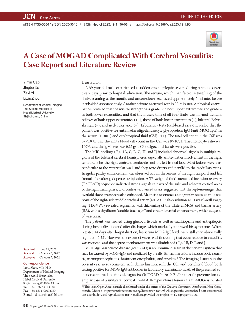 vasculitis case study report