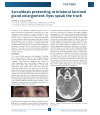 Preview image for DOS TIMES www.dosonline.org/dos-times Sarcoidosis presenting as bilateral lacrimal gland enlargement: Eyes speak the truth