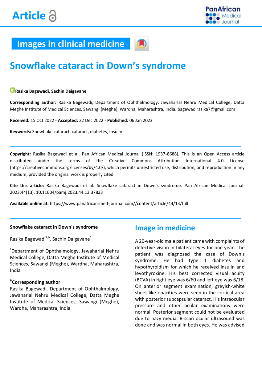 (PDF) Snowflake cataract in Down's syndrome